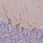 Immunohistochemical staining of human cerebellum shows weak to moderate cytoplasmic positivity in Purkinje cells.