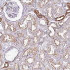 Immunohistochemical staining of human kidney shows moderate membranous positivity in cells in tubules.