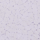 Immunohistochemical staining of human skeletal muscle shows no positivity in myocytes as expected.