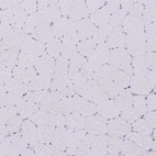 Immunohistochemical staining of human skeletal muscle shows no positivity in myocytes as expected.