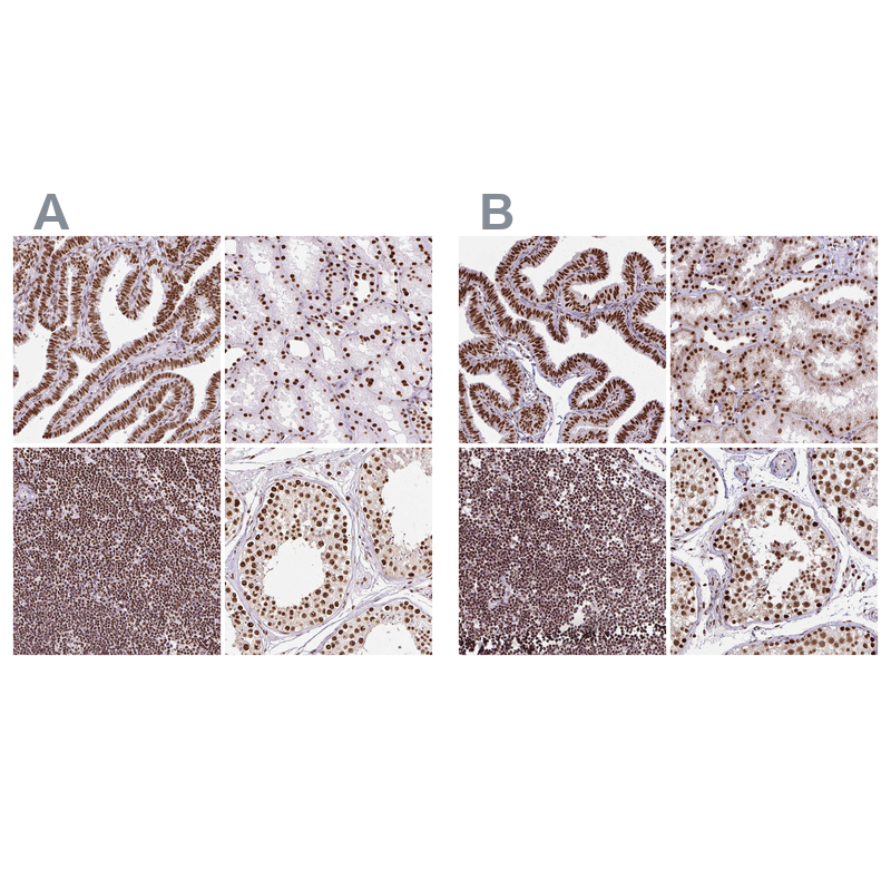 Anti-XRCC6 Antibody