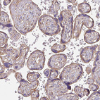 Immunohistochemical staining of human placenta shows moderate membranous positivity in trophoblastic cells.