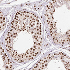Immunohistochemical staining of human testis shows strong nuclear positivity in cells in seminiferous ducts.