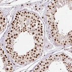 Immunohistochemical staining of human testis shows strong nuclear positivity in cells in seminiferous ducts.