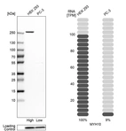 Western blot analysis in human cell lines HEK293 and PC-3 using Anti-MYH10 antibody. Corresponding MYH10 RNA-seq data are presented for the same cell lines. Loading control: Anti-PFN1.