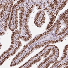 Immunohistochemical staining of human fallopian tube shows strong nuclear positivity in glandular cells.