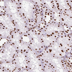 Immunohistochemical staining of human kidney shows strong nuclear positivity in cells in tubules.