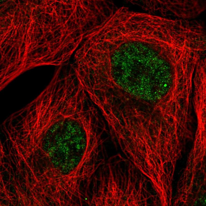 Anti-EMC7 Antibody