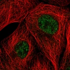 Anti-EMC7 Antibody