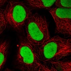 Immunofluorescent staining of human cell line HEK 293 shows localization to nucleoplasm.