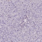 Immunohistochemical staining of human pancreas shows low expression as expected.