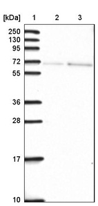 Lane 1: Marker [kDa] 250, 130, 95, 72, 55, 36, 28, 17, 10_br/_Lane 2: Human cell line RT-4_br/_Lane 3: Human cell line U-251MG sp