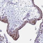 Anti-POP5 Antibody