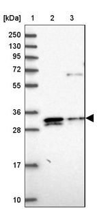 Lane 1: Marker [kDa] 250, 130, 95, 72, 55, 36, 28, 17, 10_br/_Lane 2: Human cell line RT-4_br/_Lane 3: Human cell line U-251MG sp