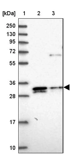 Lane 1: Marker [kDa] 250, 130, 95, 72, 55, 36, 28, 17, 10_br/_Lane 2: Human cell line RT-4_br/_Lane 3: Human cell line U-251MG sp