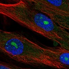 Immunofluorescent staining of human cell line BJ shows localization to nucleus, nucleoli & cytosol.