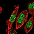 Immunofluorescent staining of human cell line PC-3 shows localization to nucleoplasm.