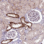 Anti-TRMT10A Antibody