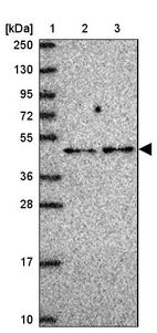 Lane 1: Marker [kDa] 250, 130, 95, 72, 55, 36, 28, 17, 10_br/_Lane 2: Human cell line RT-4_br/_Lane 3: Human cell line U-251MG sp