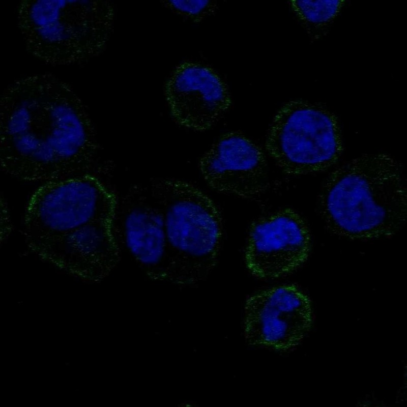 Anti-GP6 Antibody