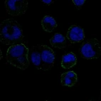 Anti-GP6 Antibody
