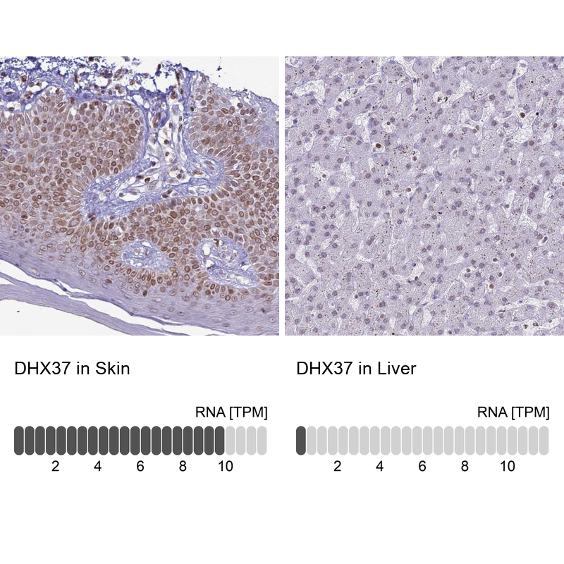 Anti-DHX37 Antibody
