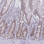 Immunohistochemical staining of human duodenum shows weak to moderate positivity in nuclear membranes in glandular cells.