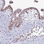 Immunohistochemical staining of human placenta shows moderate positivity in nuclear membranes in trophoblastic cells.
