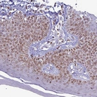 Immunohistochemical staining of human skin shows moderate positivity in nuclear membranes in squamous epithelial cells.
