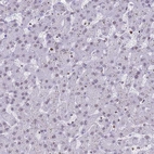 Immunohistochemical staining of human liver shows positivity in hepatocytes.