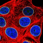 Immunofluorescent staining of human cell line MCF7 shows localization to nuclear membrane.