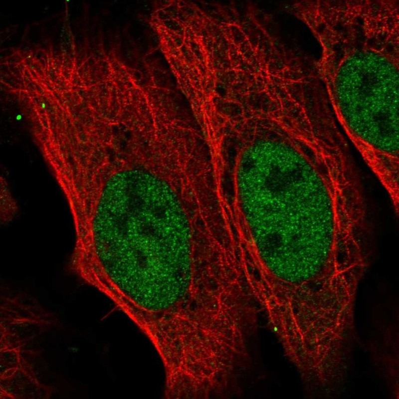 Anti-CDADC1 Antibody