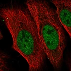 Anti-CDADC1 Antibody