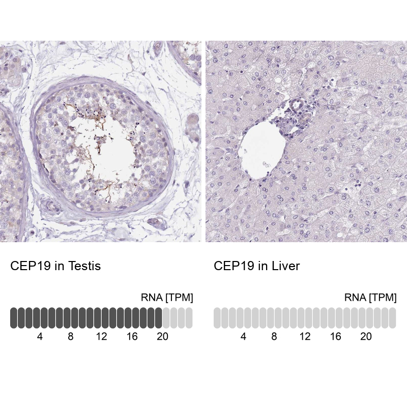 Anti-CEP19 Antibody