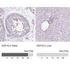 Anti-CEP19 Antibody