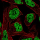 Immunofluorescent staining of human cell line RH-30 shows localization to nucleoplasm.