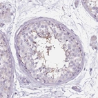 Immunohistochemical staining of human testis shows high expression.