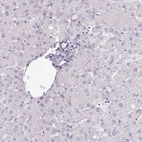 Immunohistochemical staining of human liver shows low expression as expected.