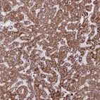 Anti-CES5A Antibody