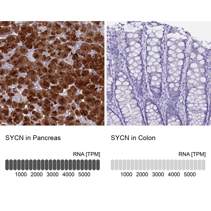 Anti-SYCN Antibody