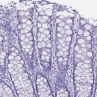 Immunohistochemical staining of human colon shows low expression as expected.