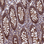 Immunohistochemical staining of human colon shows strong cytoplasmic positivity in glandular cells.