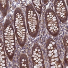 Immunohistochemical staining of human colon shows strong cytoplasmic positivity in glandular cells.