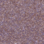 Immunohistochemical staining of human pancreas shows strong cytoplasmic positivity in exocrine glandular cells.