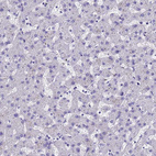 Immunohistochemical staining of human liver shows no cytoplasmic positivity in hepatocytes as expected.