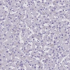 Immunohistochemical staining of human liver shows no cytoplasmic positivity in hepatocytes as expected.