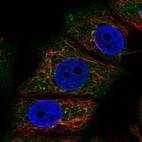 Immunofluorescent staining of human cell line MCF7 shows localization to cytosol & vesicles.