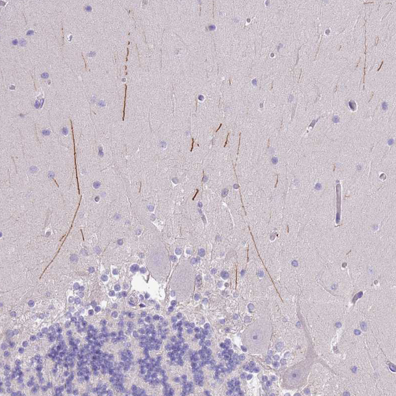 Anti-IGFL4 Antibody
