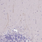 Anti-IGFL4 Antibody