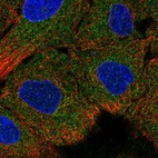 Immunofluorescent staining of human cell line A549 shows localization to cytosol.